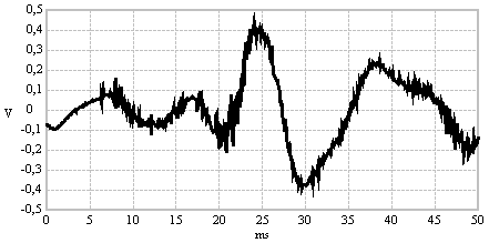 Audio signal in the oscilloscope